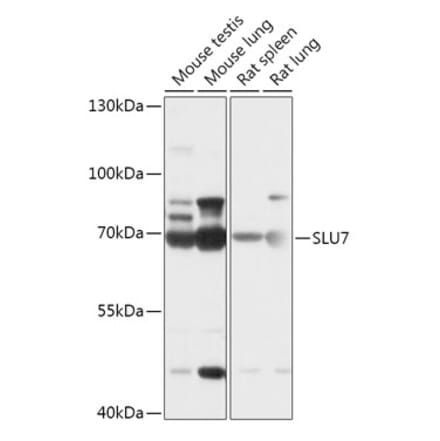 Western Blot - Anti-SLU7 Antibody (A307719) - Antibodies.com