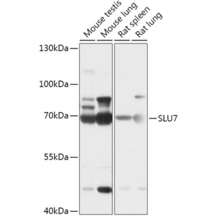 Western Blot - Anti-SLU7 Antibody (A307719) - Antibodies.com