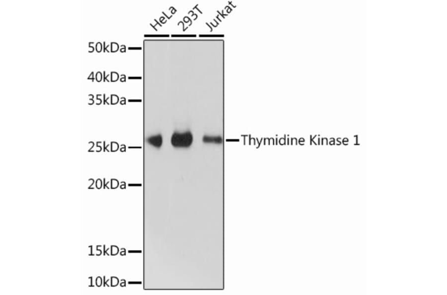 Western Blot - Anti-Thymidine Kinase 1/TK1 Antibody [ARC0719] (A307721) - Antibodies.com