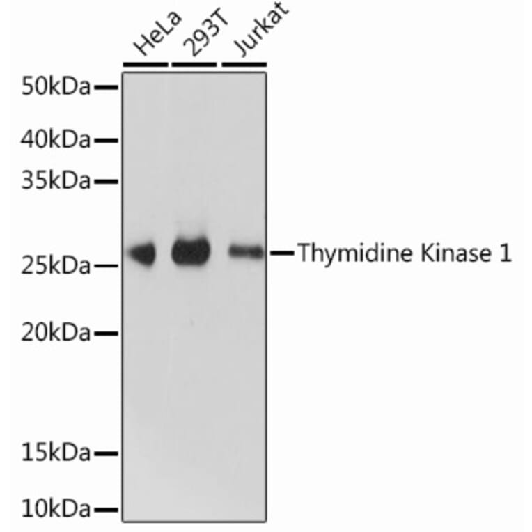 Western Blot - Anti-Thymidine Kinase 1/TK1 Antibody [ARC0719] (A307721) - Antibodies.com
