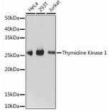 Western Blot - Anti-Thymidine Kinase 1/TK1 Antibody [ARC0719] (A307721) - Antibodies.com