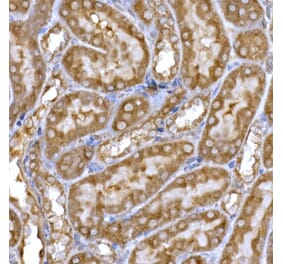 Immunohistochemistry - Anti-PPP1R3C Antibody (A307722) - Antibodies.com