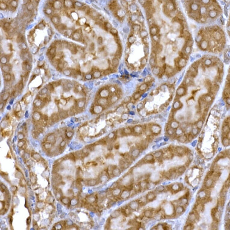 Immunohistochemistry - Anti-PPP1R3C Antibody (A307722) - Antibodies.com