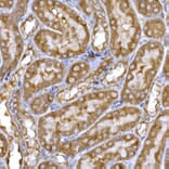 Immunohistochemistry - Anti-PPP1R3C Antibody (A307722) - Antibodies.com