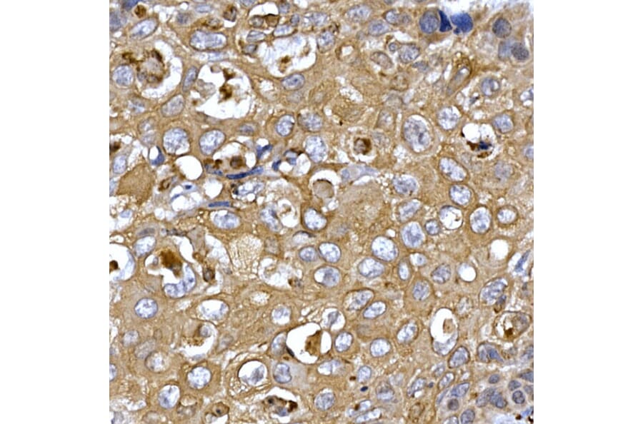 Immunohistochemistry - Anti-PPP1R3C Antibody (A307722) - Antibodies.com
