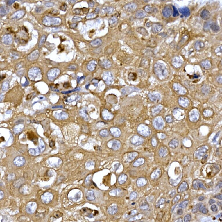 Immunohistochemistry - Anti-PPP1R3C Antibody (A307722) - Antibodies.com