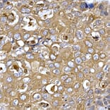 Immunohistochemistry - Anti-PPP1R3C Antibody (A307722) - Antibodies.com