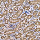 Immunohistochemistry - Anti-PPP1R3C Antibody (A307722) - Antibodies.com