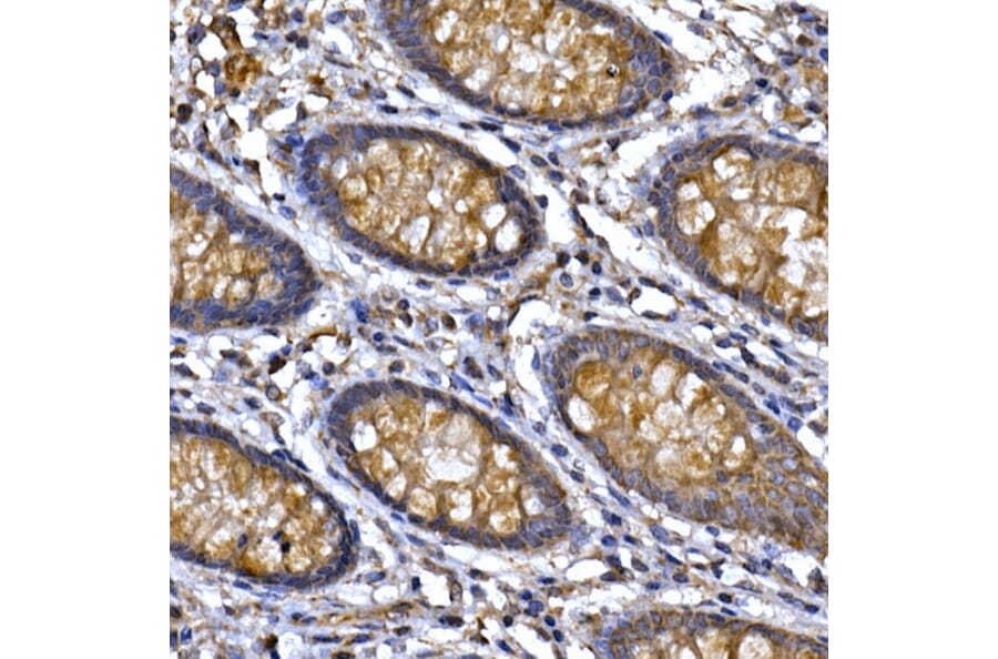 Immunohistochemistry - Anti-PPP1R3C Antibody (A307722) - Antibodies.com