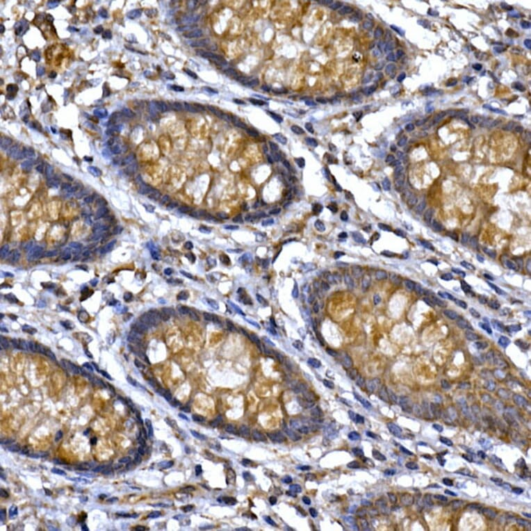 Immunohistochemistry - Anti-PPP1R3C Antibody (A307722) - Antibodies.com