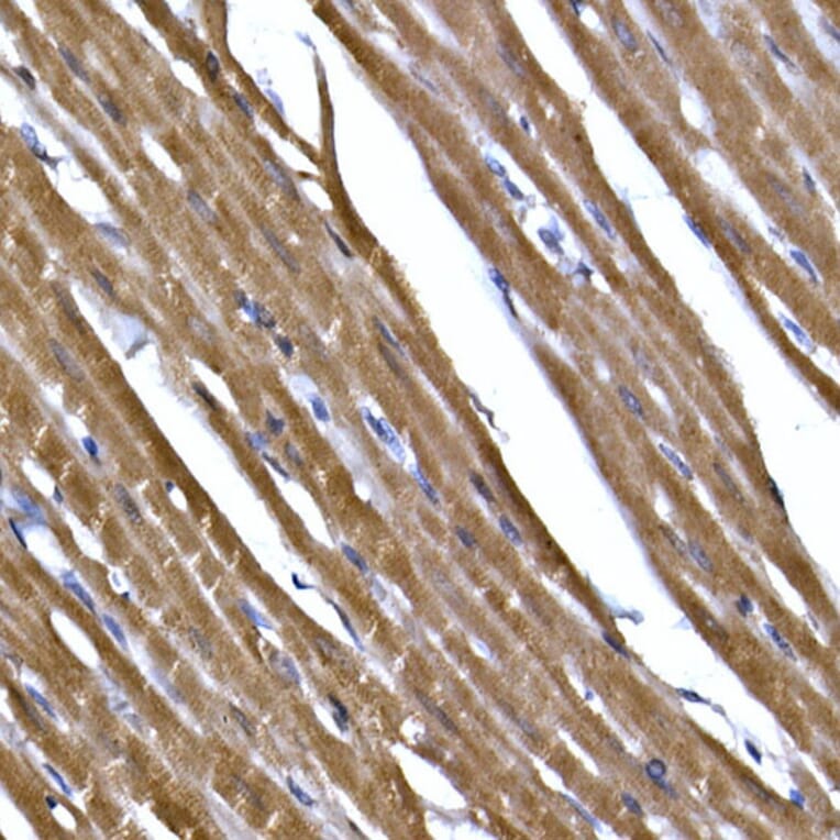 Immunohistochemistry - Anti-PPP1R3C Antibody (A307722) - Antibodies.com