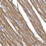 Immunohistochemistry - Anti-PPP1R3C Antibody (A307722) - Antibodies.com