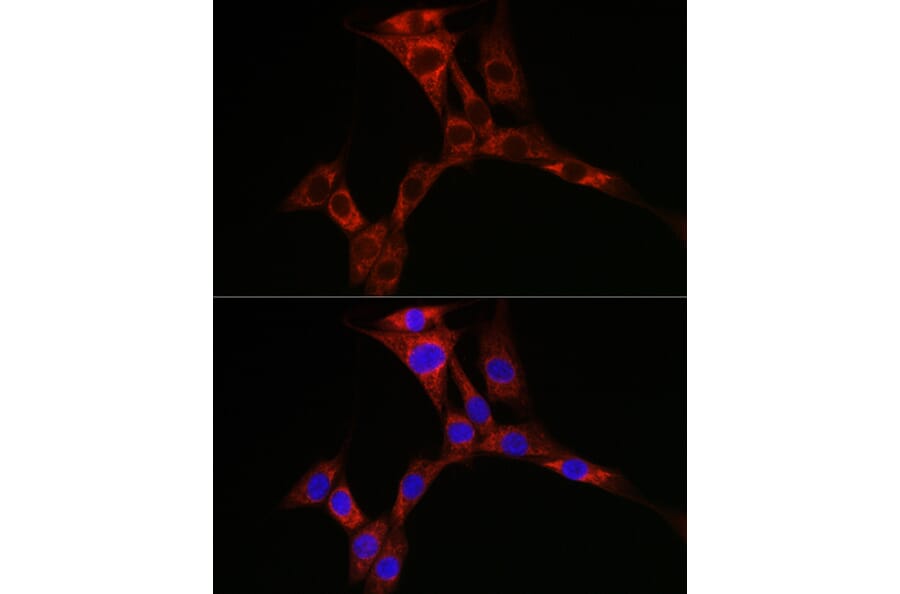 Immunofluorescence - Anti-PPP1R3C Antibody (A307722) - Antibodies.com