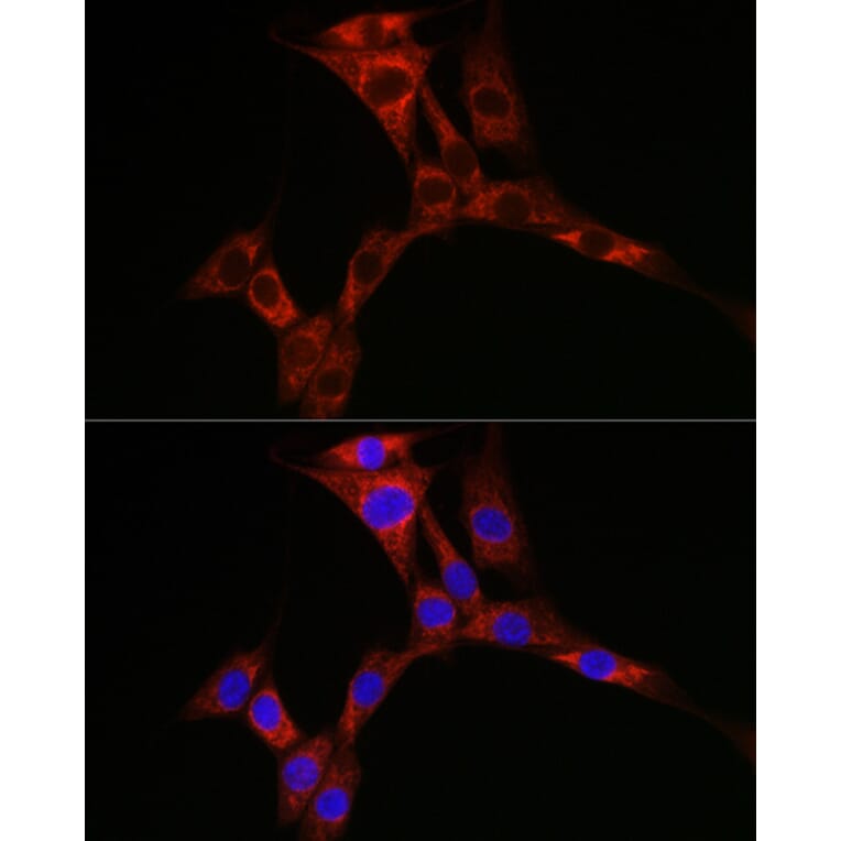 Immunofluorescence - Anti-PPP1R3C Antibody (A307722) - Antibodies.com