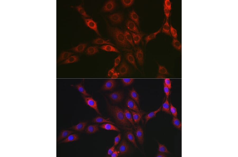 Immunofluorescence - Anti-PPP1R3C Antibody (A307722) - Antibodies.com