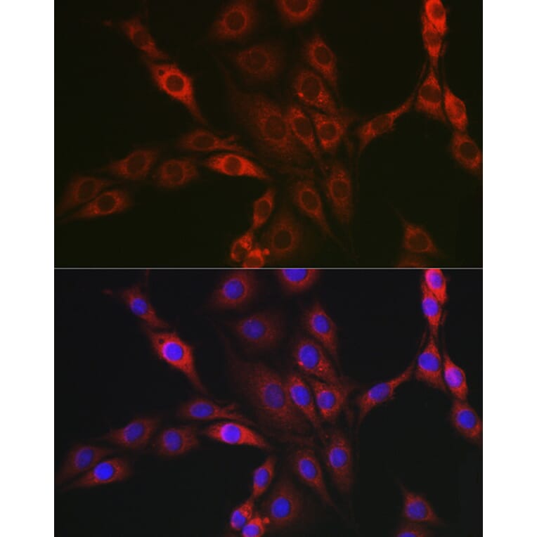 Immunofluorescence - Anti-PPP1R3C Antibody (A307722) - Antibodies.com