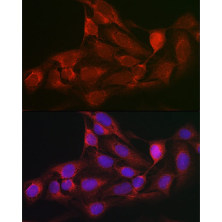 Immunofluorescence - Anti-PPP1R3C Antibody (A307722) - Antibodies.com