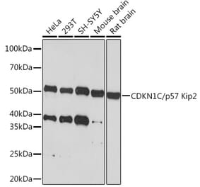 Western Blot - Anti-p57 Kip2 Antibody [ARC1424] (A307723) - Antibodies.com