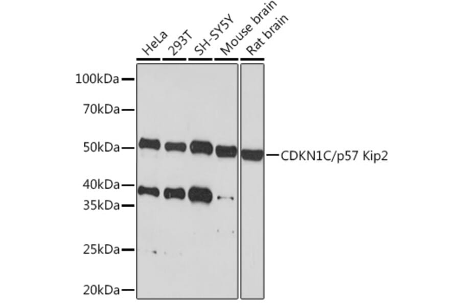 Western Blot - Anti-p57 Kip2 Antibody [ARC1424] (A307723) - Antibodies.com