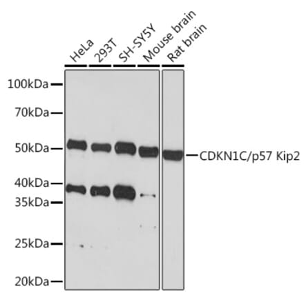 Western Blot - Anti-p57 Kip2 Antibody [ARC1424] (A307723) - Antibodies.com