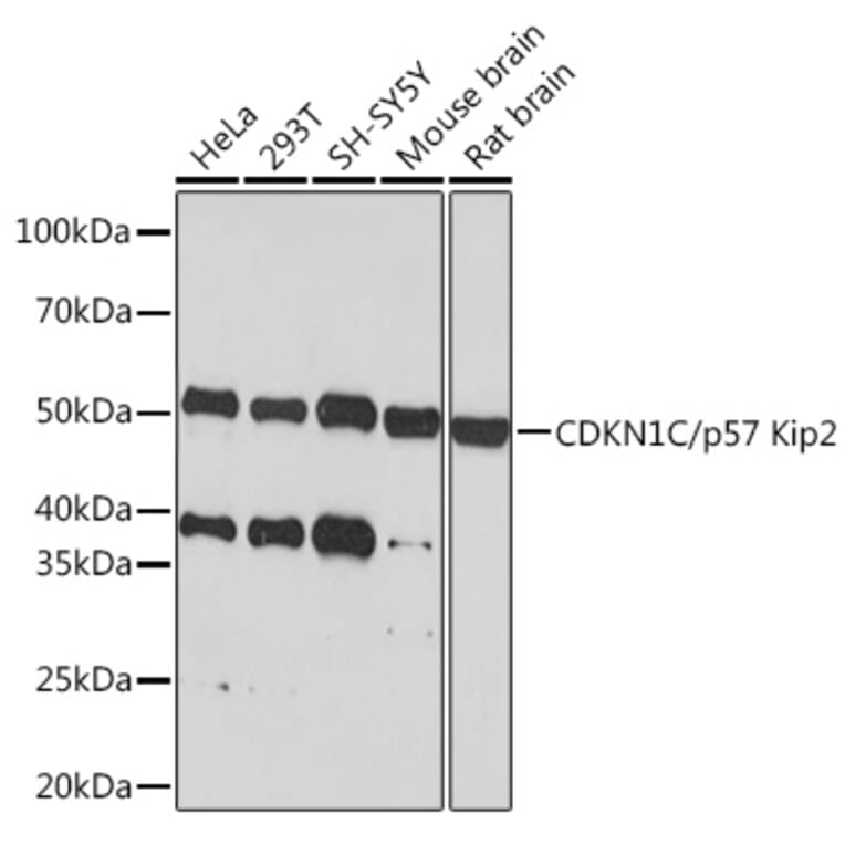 Western Blot - Anti-p57 Kip2 Antibody [ARC1424] (A307723) - Antibodies.com