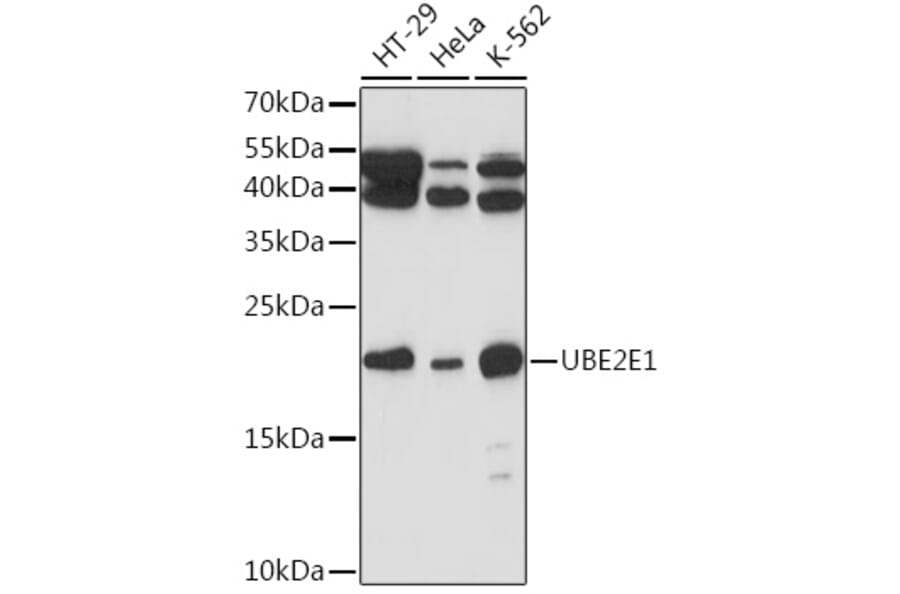 Western Blot - Anti-UBCH6/UBE2E1 Antibody (A307724) - Antibodies.com