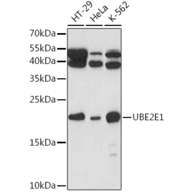 Western Blot - Anti-UBCH6/UBE2E1 Antibody (A307724) - Antibodies.com