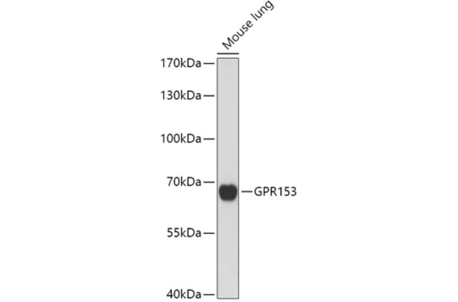 Western Blot - Anti-GPR 153 Antibody (A307725) - Antibodies.com