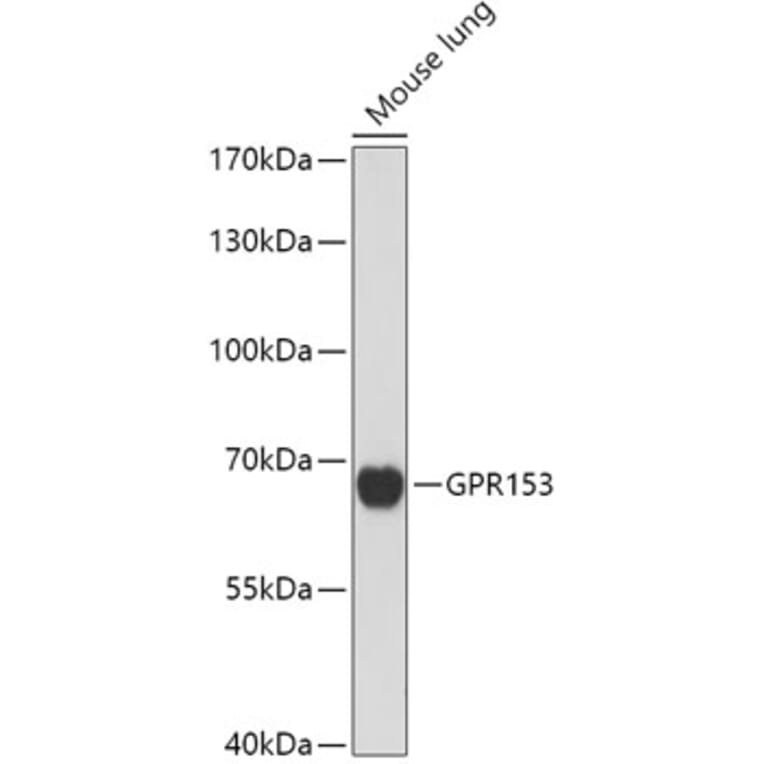 Western Blot - Anti-GPR 153 Antibody (A307725) - Antibodies.com