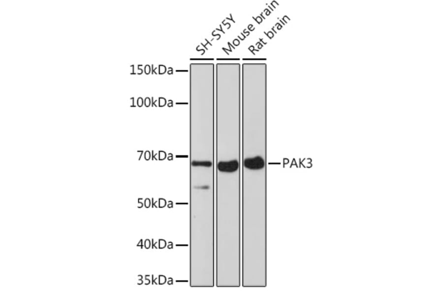 Western Blot - Anti-PAK3 Antibody [ARC1955] (A307726) - Antibodies.com