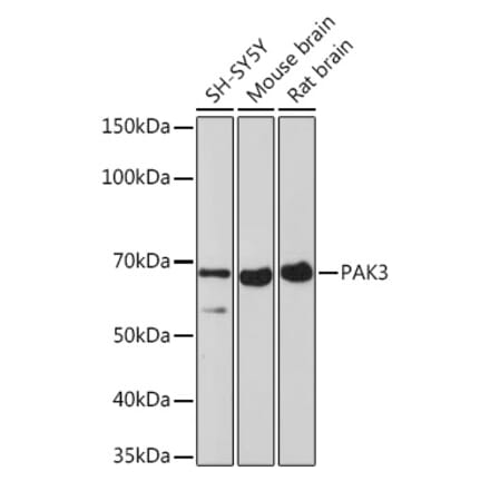 Western Blot - Anti-PAK3 Antibody [ARC1955] (A307726) - Antibodies.com