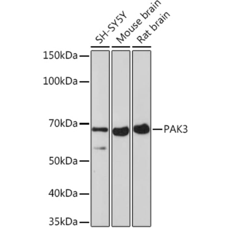Western Blot - Anti-PAK3 Antibody [ARC1955] (A307726) - Antibodies.com