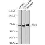 Western Blot - Anti-PAK3 Antibody [ARC1955] (A307726) - Antibodies.com