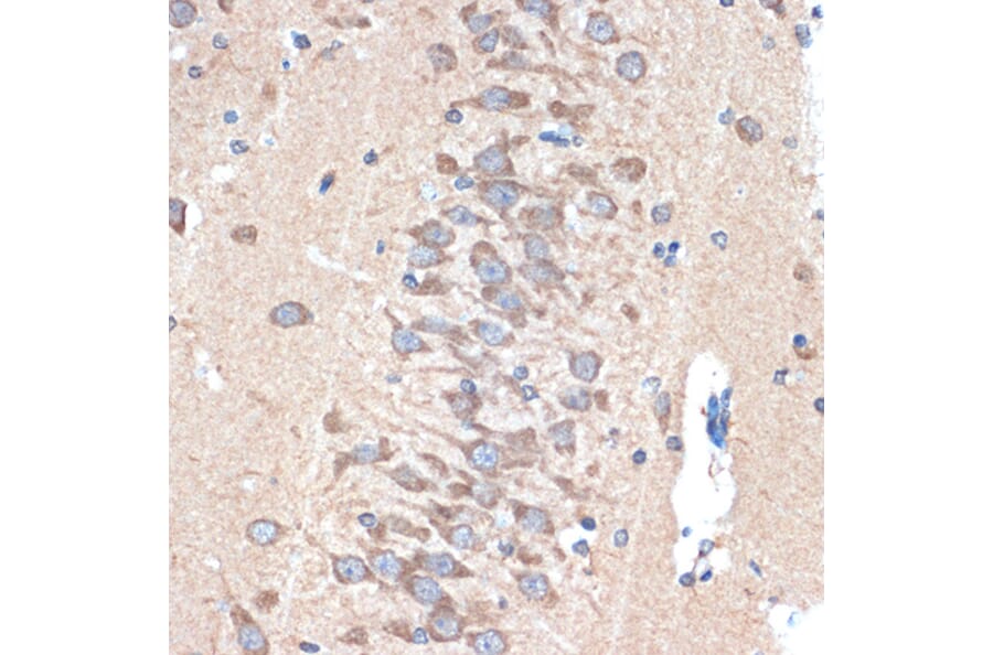 Immunohistochemistry - Anti-PAK3 Antibody [ARC1955] (A307726) - Antibodies.com