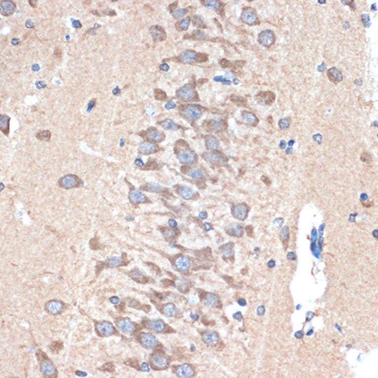 Immunohistochemistry - Anti-PAK3 Antibody [ARC1955] (A307726) - Antibodies.com