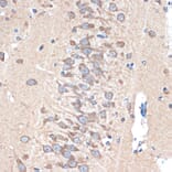 Immunohistochemistry - Anti-PAK3 Antibody [ARC1955] (A307726) - Antibodies.com
