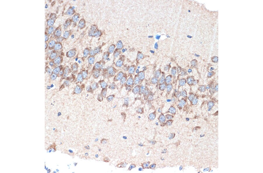 Immunohistochemistry - Anti-PAK3 Antibody [ARC1955] (A307726) - Antibodies.com