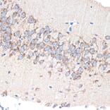 Immunohistochemistry - Anti-PAK3 Antibody [ARC1955] (A307726) - Antibodies.com
