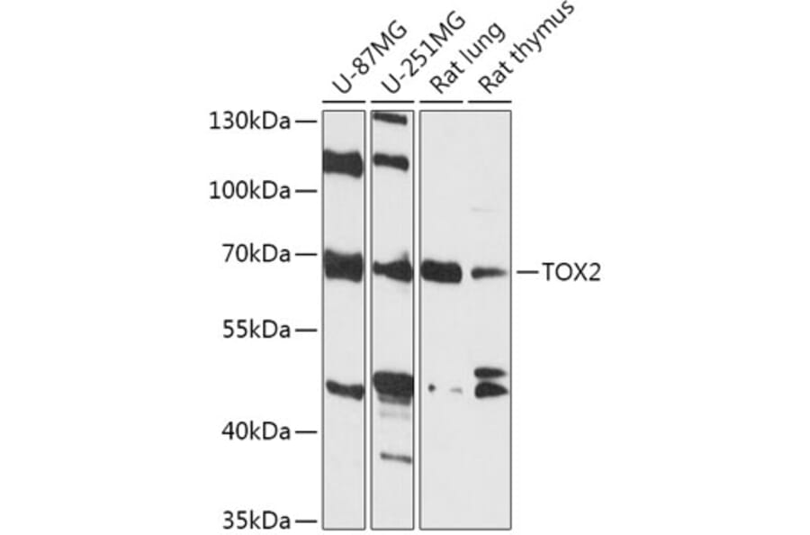 Western Blot - Anti-TOX2 Antibody (A307727) - Antibodies.com