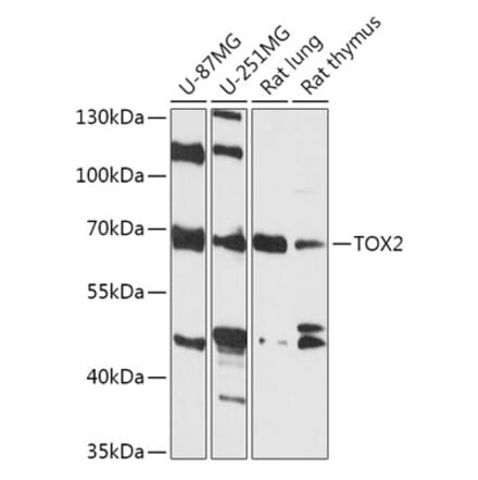 Western Blot - Anti-TOX2 Antibody (A307727) - Antibodies.com