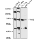 Western Blot - Anti-TOX2 Antibody (A307727) - Antibodies.com
