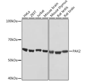 Western Blot - Anti-PAK2 Antibody [ARC1030] (A307728) - Antibodies.com