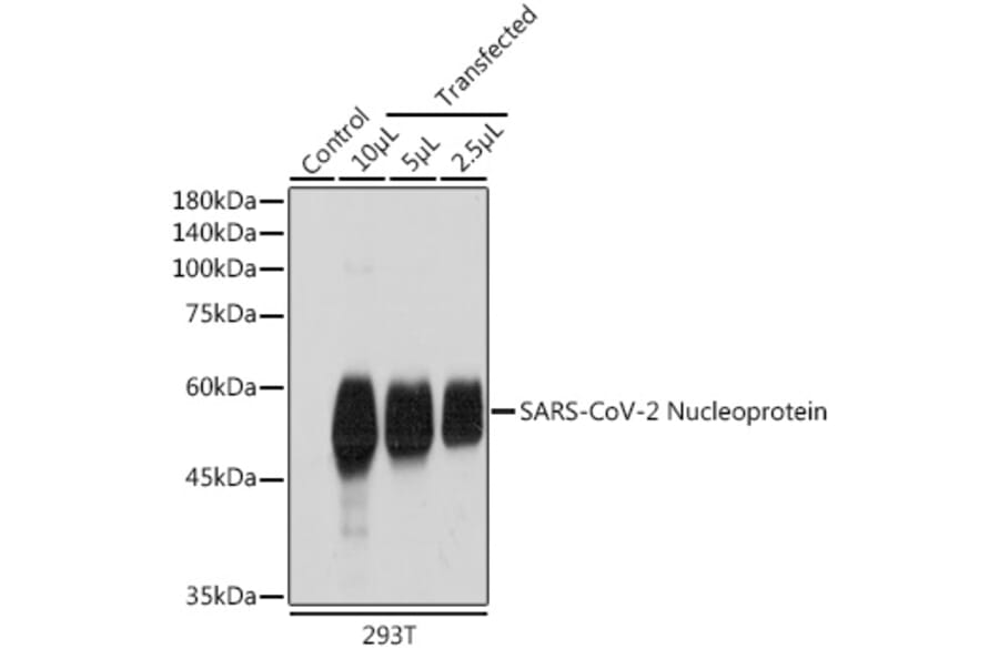 Western Blot - Anti-SARS-CoV2 Nucleoprotein Antibody (A307731) - Antibodies.com