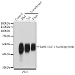 Western Blot - Anti-SARS-CoV2 Nucleoprotein Antibody (A307731) - Antibodies.com