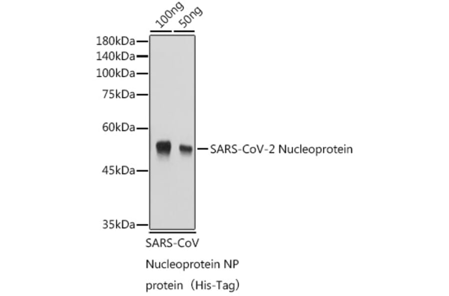 Western Blot - Anti-SARS-CoV2 Nucleoprotein Antibody (A307731) - Antibodies.com