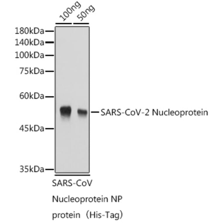 Western Blot - Anti-SARS-CoV2 Nucleoprotein Antibody (A307731) - Antibodies.com