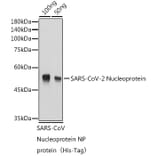 Western Blot - Anti-SARS-CoV2 Nucleoprotein Antibody (A307731) - Antibodies.com