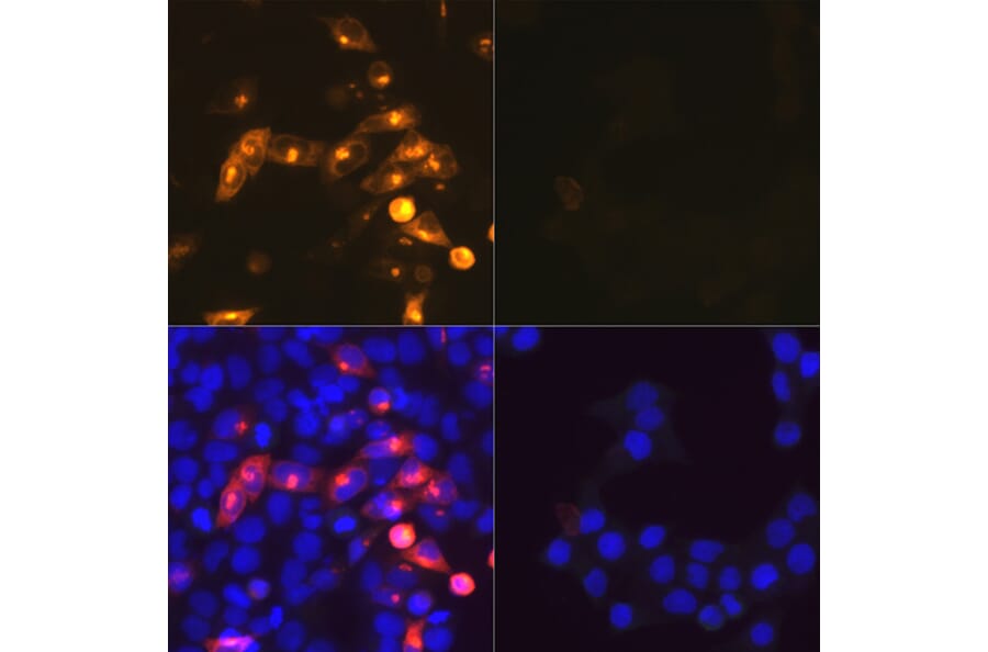 Immunofluorescence - Anti-SARS-CoV2 Nucleoprotein Antibody (A307731) - Antibodies.com