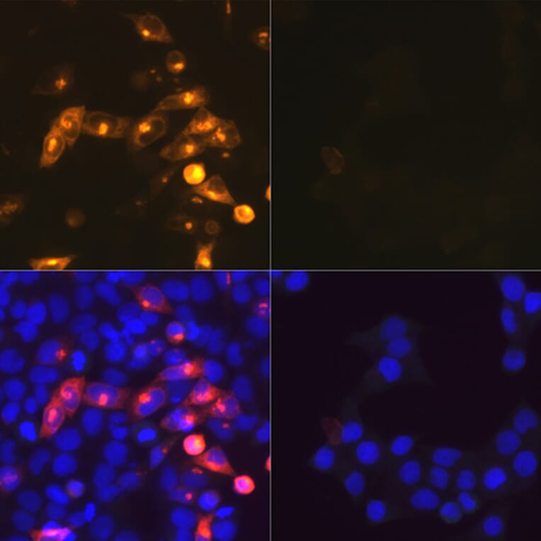 Immunofluorescence - Anti-SARS-CoV2 Nucleoprotein Antibody (A307731) - Antibodies.com