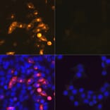 Immunofluorescence - Anti-SARS-CoV2 Nucleoprotein Antibody (A307731) - Antibodies.com